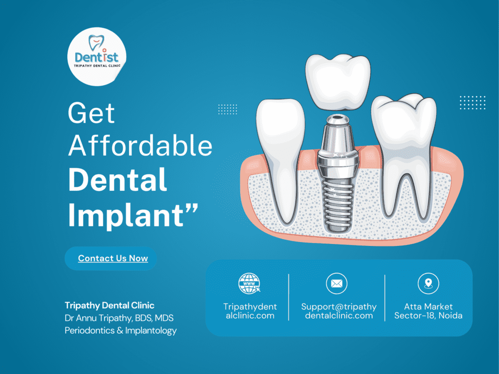 “how much dental implants cost in noida, at the best dental clinic in noida? ”