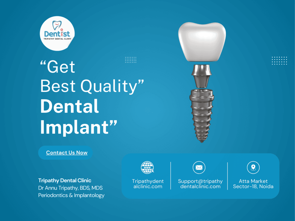 Best dental implants in noida: a complete guide to restoring your smile